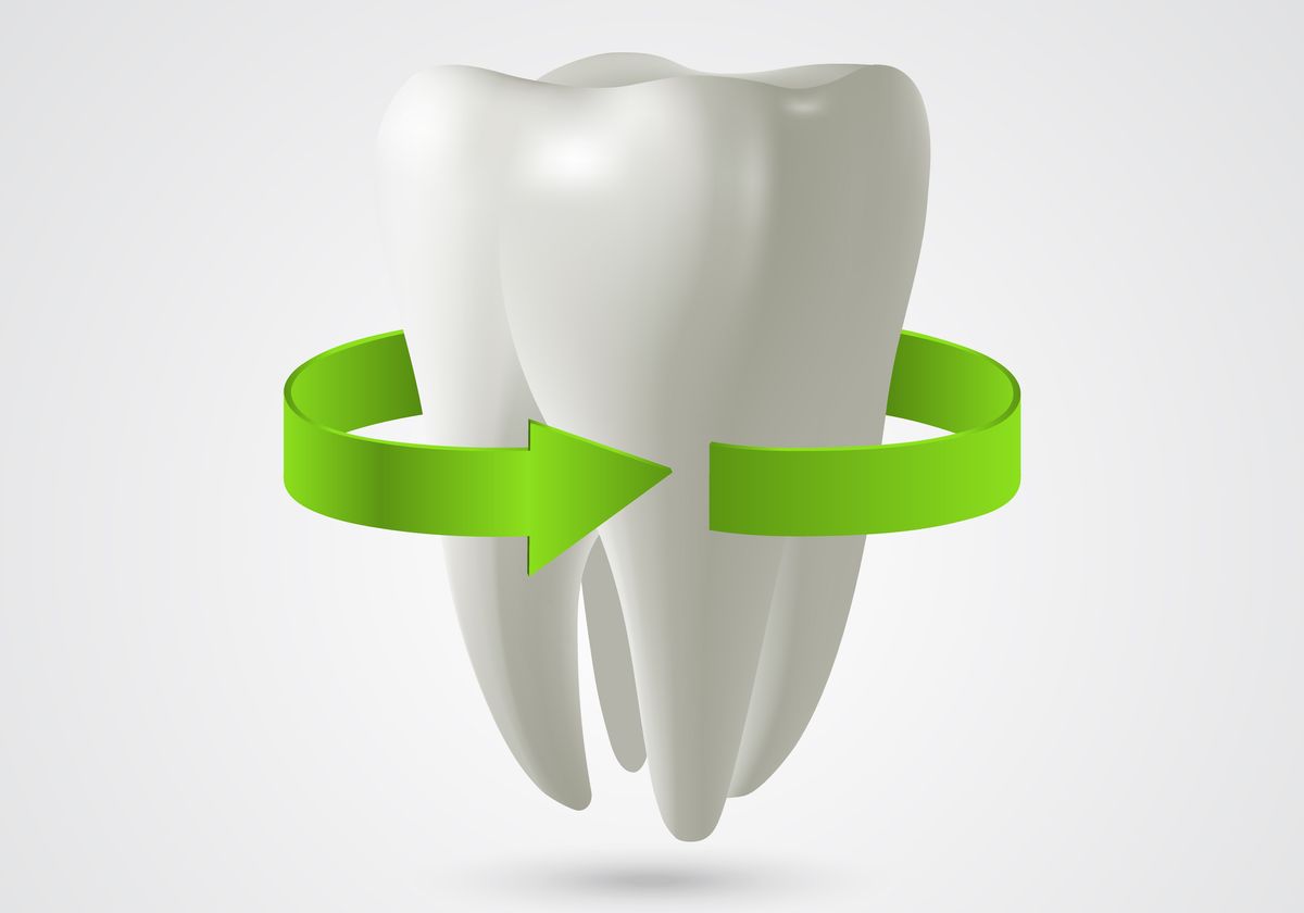 Green dentistry – An emerging need of hour