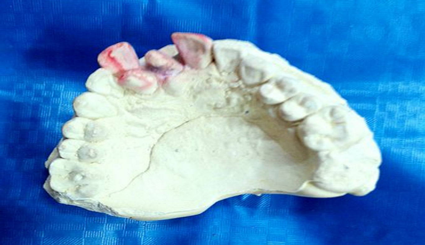 More than 32 teeth in your mouth?
