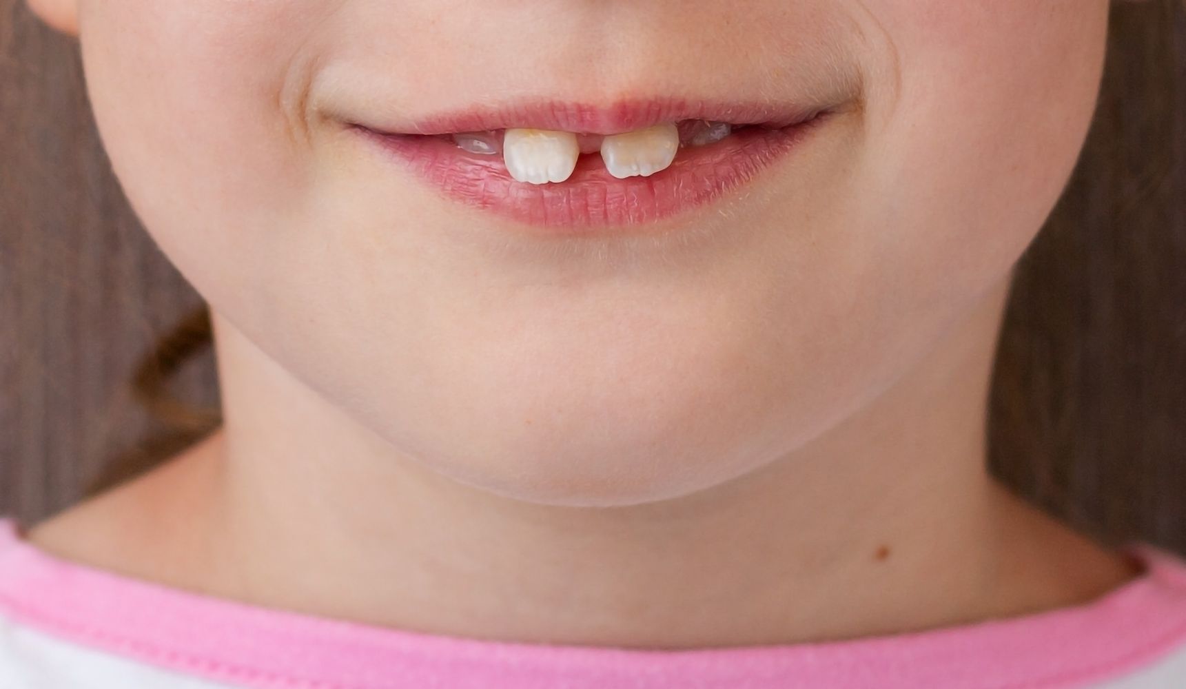 Is your child in the ugly duckling stage?