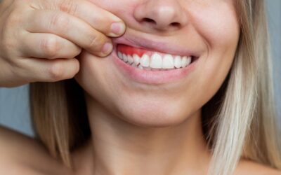 Gum diseases