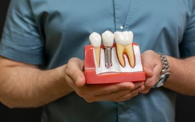 Why are dental implants so expensive?