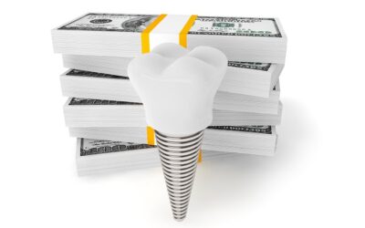 Reasons for cost variation in dental implants