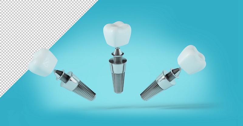 Dental implant mock-up in different positions on blue background