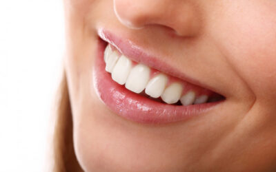 Busting Myths around Smile designing