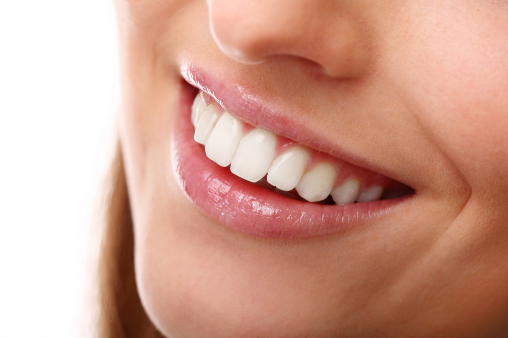 perfect-smile-with-white-teeth- Busting Myths around Smile designing