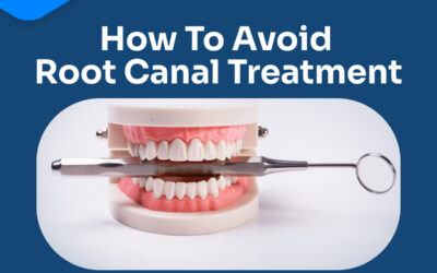 Pit and fissure sealants could save root canal treatment