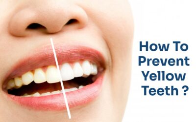 Prevent yellow teeth with Less brushing pressure on teeth