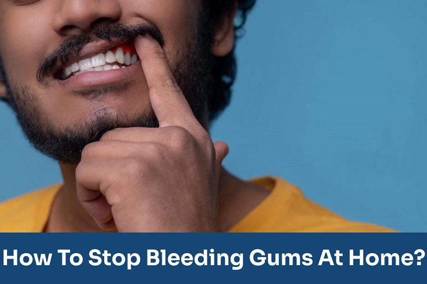 Bleeding mouth – What can go wrong?