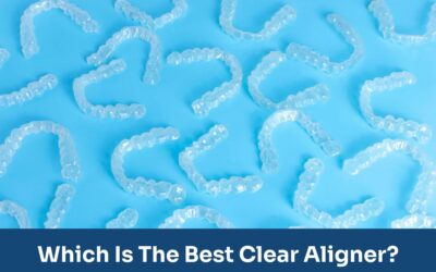 How are clear aligners made?