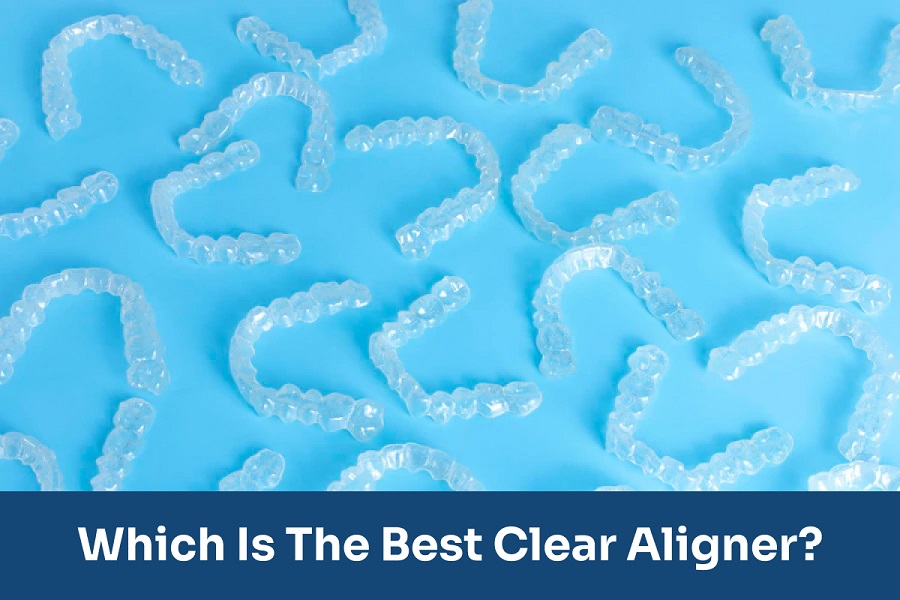 How are clear aligners made