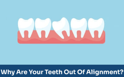 Maligned mouth- Why are your teeth out of alignment?