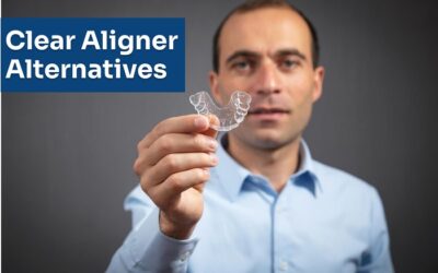 Alternative options to clear aligners