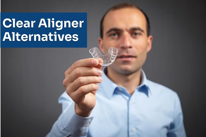 Alternative options to clear aligners
