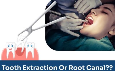 Which is better tooth extraction or root canal