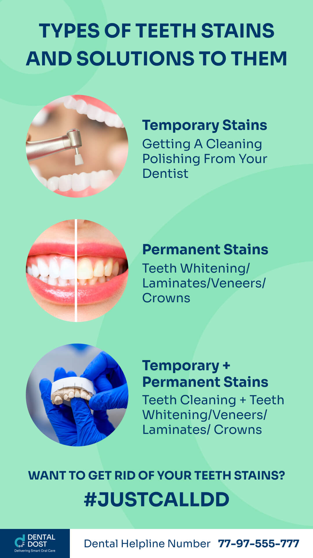 Infographics_on_types_of_teeth_stains_and_solutions_to them