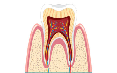 Root Canal Treatment