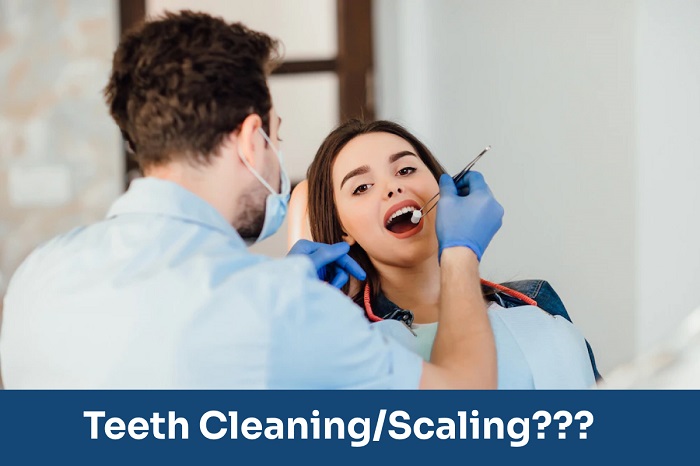 Importance of tooth scaling and cleaning