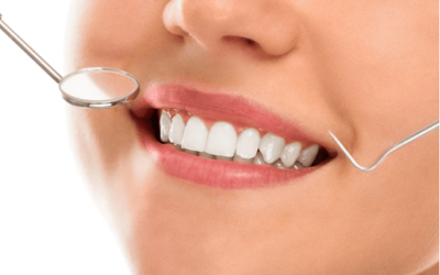Teeth scaling and polishing