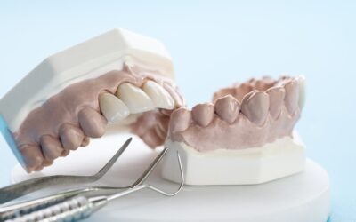 Interdental Cleaning Techniques for Optimal Oral Health