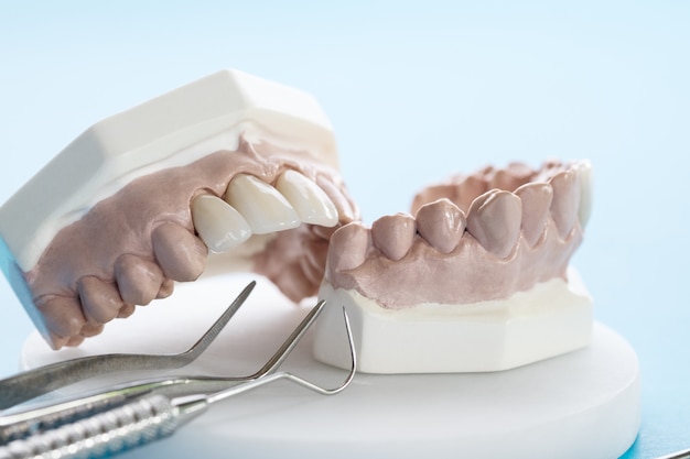 interdental cleaning