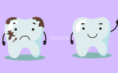 Remove Black Stains & Reveal Your Brightest Smile