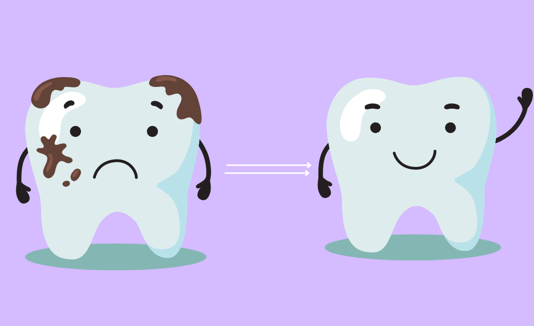Remove Black Stains & Reveal Your Brightest Smile