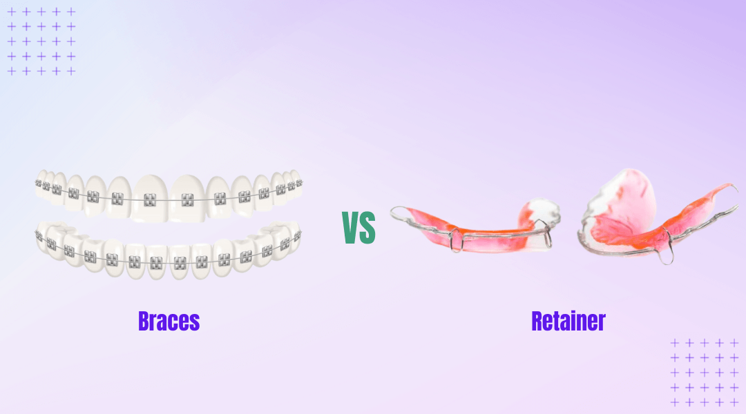 Braces vs Retainers